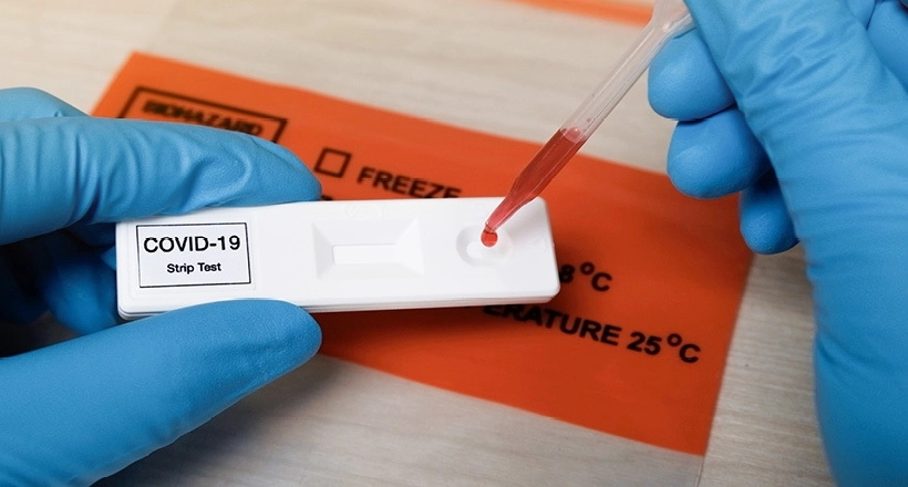 Otkriven novi test za merenje kovid antitjela