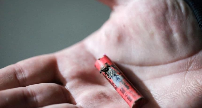 Petarda teško povrijedila dijete, prevezeno u UKC