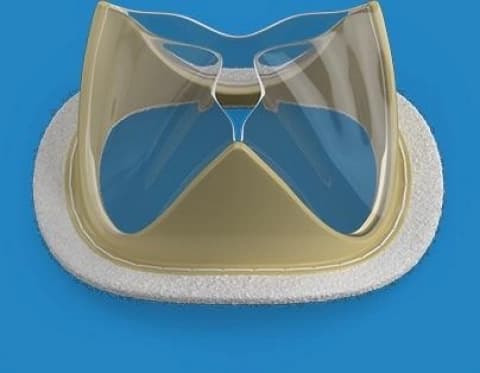 Presađeno prvo vještačko srce od bioplastike