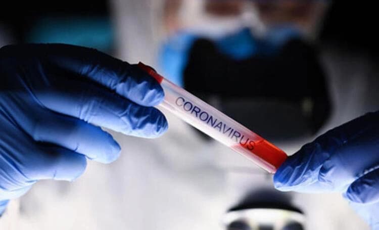 U Srpskoj 19 osoba pozitivno na virus