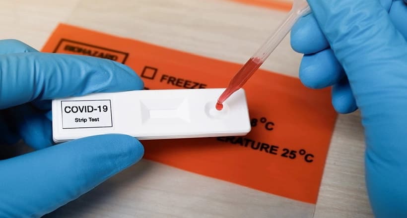 U Srpskoj nema preminulih, zaraženo još 17 osoba