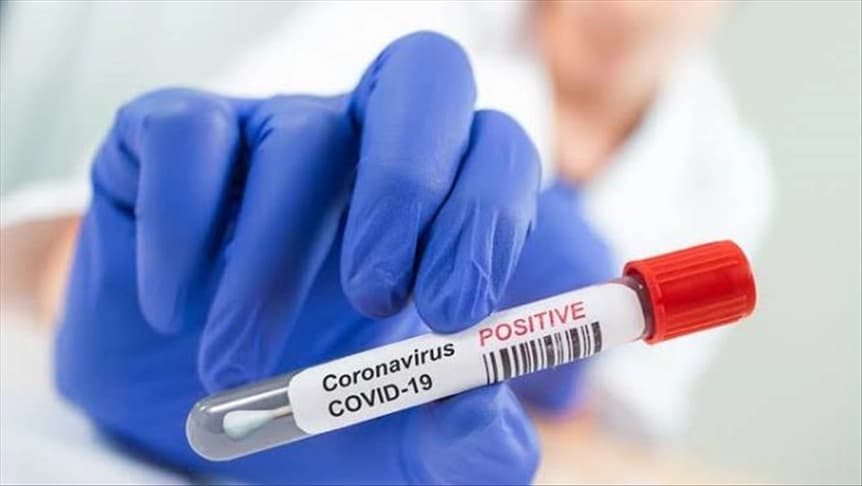 Bitku izgubilo 15 oboljelih: U Srpskoj još 86 osoba pozitivnih na korona virus