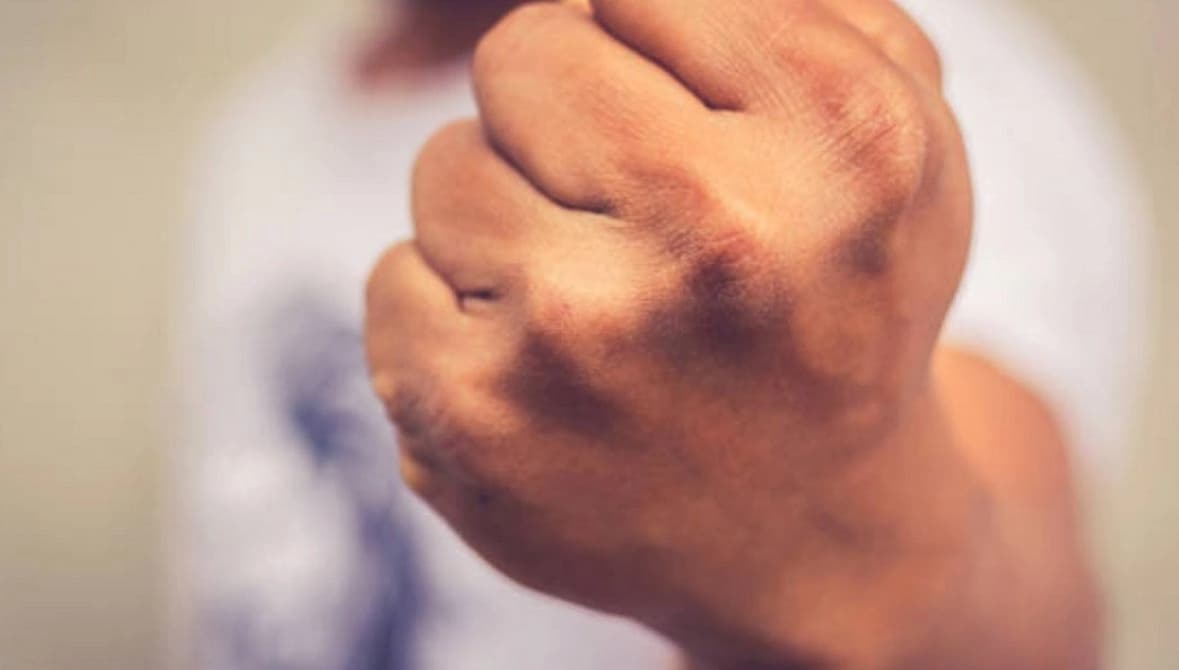 Udarali se i rukama i nogama! Pesničenje u centru Banjaluke, dva mladića povrijeđena